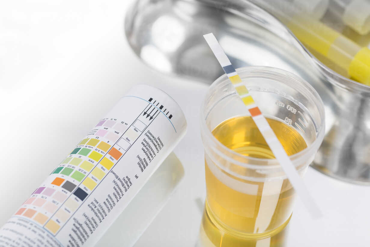 Routine test, urine rapid test, urine test strip, urine sample – Stockphoto