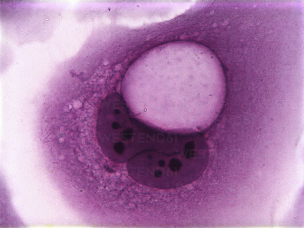 papilloma squamous epithelial cell nemathelminthes phylum